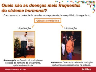 Quais s ão  as doenças mais frequentes do sistema hormonal? O excesso ou a carência de uma hormona pode afectar o equilíbrio do organismo. Glândula endócrina Hiperfunção Hipofunção Acromegalia  — Quando há produção em excesso da hormona do crescimento,  após a adolescência. Nanismo  — Quando há deficiente produção da hormona do crescimento, na infância. Planeta Terra — 9.º ano 