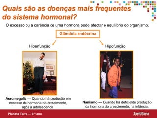 Quais são as doenças mais frequentes do sistema hormonal?O excesso ou a carência de uma hormona pode afectar o equilíbrio do organismo.Glândula endócrinaHiperfunçãoHipofunçãoAcromegalia — Quando há produção em excesso da hormona do crescimento, após a adolescência.Nanismo — Quando há deficiente produção da hormona do crescimento, na infância.Planeta Terra — 9.º ano