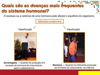 Quais são as doenças mais frequentes
do sistema hormonal?
O excesso ou a carência de uma hormona pode afectar o equilíbrio do organismo.
Glândula endócrina
Hiperfunção

Acromegalia — Quando há produção em
excesso da hormona do crescimento,
após a adolescência.

Hipofunção

Nanismo — Quando há deficiente produção
da hormona do crescimento, na infância.

 