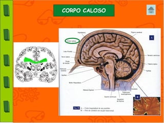 CORPO CALOSO
 