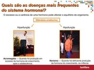 Quais s ão  as doenças mais frequentes do sistema hormonal? O excesso ou a carência de uma hormona pode afectar o equilíbrio do organismo. Glândula endócrina Hiperfunção Hipofunção Acromegalia  — Quando há produção em excesso da hormona do crescimento,  após a adolescência. Nanismo  — Quando há deficiente produção da hormona do crescimento, na infância. 