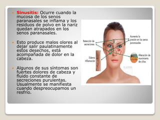  Sinusitis: Ocurre cuando la
mucosa de los senos
paranasales se inflama y los
residuos de polvo en la nariz
quedan atrapados en los
senos paranasales.
 Esto produce malos olores al
dejar salir paulatinamente
estos desechos, está
acompañada de dolor en la
cabeza.
 Algunos de sus síntomas son
fuertes dolores de cabeza y
fluido constante de
secreciones purulentas.
Usualmente se manifiesta
cuando despreocupamos un
resfrío.
 