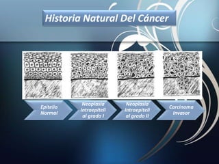Historia Natural Del Cáncer
Epitelio
Normal
Neoplasia
Intraepiteli
al grado I
Neoplasia
Intraepiteli
al grado II
Carcinoma
Invasor
 