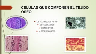 CELULAS QUE COMPONEN EL TEJIDO
OSEO
 OSTEOPROGENITORAS
 OSTEOBLASTOS
 OSTEOCITOS
 Y OSTEOCLASTOS
 