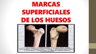 MARCAS
SUPERFICIALES
DE LOS HUESOS
 