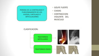 PERDIDA DE LA CONTINUIDAD Y
FUNCIONAMIENTO DE LOS
HUESOS, CARTILAGO O
ARTICULACIONES
• GOLPE FUERTE
• CAIDAS
• CONTRACCION
VIOLENTA DEL
MUSCULO
CLASIFICACION:
TRASTORNOS
ARTICULARES
TRASTORNOS OSEOS
 