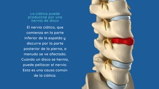 El nervio ciático, que
comienza en la parte
inferior de la espalda y
discurre por la parte
posterior de la pierna, a
menudo se ve afectado.
Cuando un disco se hernia,
puede pellizcar el nervio.
Esta es una causa común
de la ciática.
La ciática puede
producirse por una
hernia de disco
 