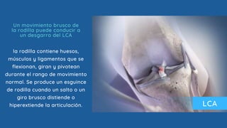 la rodilla contiene huesos,
músculos y ligamentos que se
flexionan, giran y pivotean
durante el rango de movimiento
normal. Se produce un esguince
de rodilla cuando un salto o un
giro brusco distiende o
hiperextiende la articulación.
Un movimiento brusco de
la rodilla puede conducir a
un desgarro del LCA
LCA
 