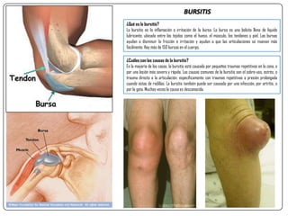 ¿Qué es la bursitis?
La bursitis es la inflamación o irritación de la bursa. La bursa es una bolsita llena de líquido
lubricante, ubicada entre los tejidos como el hueso, el músculo, los tendones y piel. Las bursas
ayudan a disminuir la fricción e irritación y ayudan a que las articulaciones se muevan más
fácilmente. Hay más de 150 bursas en el cuerpo.
BURSITIS
¿Cuáles son las causas de la bursitis?
En la mayoría de los casos, la bursitis está causada por pequeños traumas repetitivos en la zona, o
por una lesión más severa y rápida. Las causas comunes de la bursitis son el sobre-uso, estrés, o
trauma directo a la articulación, específicamente con traumas repetitivas o presión prolongada
cuando estas de rodillas. La bursitis también puede ser causada por una infección, por artritis, o
por la gota. Muchas veces la causa es desconocida.
 