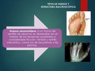 Huesos sesamoideos (con forma de
semilla de sésamo) se desarrollan en el
interior de los tendones sometidos a
considerable fricción, tensión y estrés
mecánico, como los de las palmas y las
plantas.
TIPOS DE HUESOS Y
ESTRUCTURA MACROSCÓPICA
 