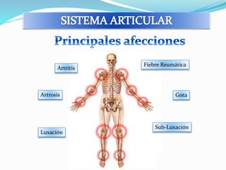 Artritis 
Artrosis 
Fiebre Reumática 
Gota 
Luxación 
Sub-Luxación 
 
