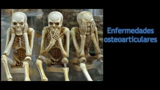 Enfermedades
osteoarticulares
 