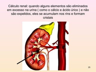 Cálculo renal: quando alguns elementos são eliminados
em excesso na urina ( como o cálcio e ácido úrico ) e não
  são expelidos, eles se acumulam nos rins e formam
                         cristais




                                                        25
 