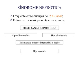 SÍNDROME NEFRÓTICA
 Freqüente entre crianças de 2 a 7 anos;
 É duas vezes mais presente em meninos;
MEMBRANA GLOMERULARMEMBRANA GLOMERULAR
HiperalbuminúriaHiperalbuminúria HipoalminemiaHipoalminemia
Edema nos espaços intersticiais e asciteEdema nos espaços intersticiais e ascite
HipovolemiaHipovolemia
 