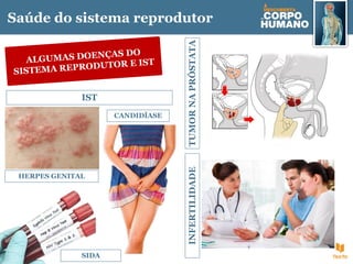 Saúde do sistema reprodutor
ALGUMAS DOENÇAS DO
SISTEMA REPRODUTOR E IST
INFERTILIDADE
TUMOR
NA
PRÓSTATA
IST
HERPES GENITAL
CANDIDÍASE
SIDA
 