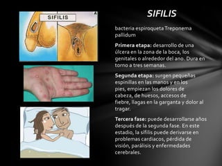 SIFILIS
bacteria espiroqueta Treponema
pallidum
Primera etapa: desarrollo de una
úlcera en la zona de la boca, los
genitales o alrededor del ano. Dura en
torno a tres semanas.
Segunda etapa: surgen pequeñas
espinillas en las manos y en los
pies, empiezan los dolores de
cabeza, de huesos, accesos de
fiebre, llagas en la garganta y dolor al
tragar.
Tercera fase: puede desarrollarse años
después de la segunda fase. En este
estadio, la sífilis puede derivarse en
problemas cardiacos, pérdida de
visión, parálisis y enfermedades
cerebrales.
 