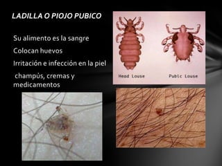 LADILLA O PIOJO PUBICO

Su alimento es la sangre
Colocan huevos
Irritación e infección en la piel
champús, cremas y
medicamentos
 