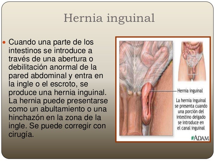 Los aumentos del pene sin operaciones.