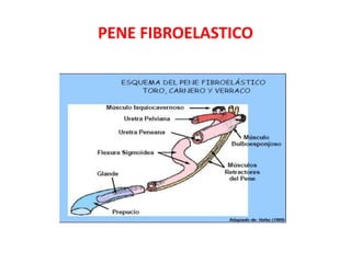 PENE FIBROELASTICO
 