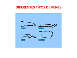 DIFERENTES TIPOS DE PENES
 