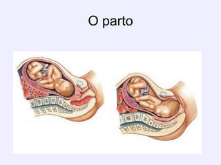 O parto