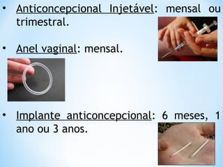 • Anticoncepcional Injetável: mensal ou
trimestral.
• Anel vaginal: mensal.
• Implante anticoncepcional: 6 meses, 1
ano ou 3 anos.
 