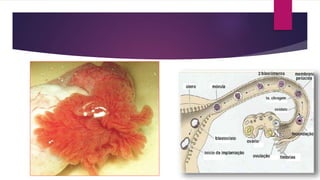 2. Tubas uterinas:
 12-14 cm, que se estendem
desde cada um dos ovários
até à parte superior do útero
 Local onde ocorre a
fecundação
 Possui fímbrias, infundíbulo
e ampola
 