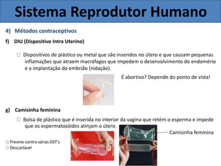 Sistema Reprodutor Humano
4) Métodos contraceptivos
f) DIU (Dispositivo Intra Uterino)
Dispositivos de plástico ou metal que são inseridos no útero e que causam pequenas
inflamações que atraem macrófagos que impedem o desenvolvimento do endomério
e a implantação do embrião (nidação).
É abortivo? Depende do ponto de vista!
g) Camisinha feminina
Bolsa de plástico que é inserida no interior da vagina que retém o esperma e impede
que os espermatozóides atinjam o útero.
Camisinha feminina
Previne contra várias DST’s
Descartável
 