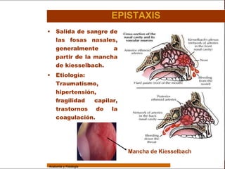 Sistema Respiratorio

                                         EPISTAXIS
                 •   Salida de sangre de
                     las fosas nasales,
     Sistema
                     generalmente      a
Fosas Nasales        partir de la mancha
     Faringe         de kiesselbach.
                 •   Etiología:
     Laringe
                     Traumatismo,
     Tráquea
                     hipertensión,
   Bronquios         fragilidad  capilar,
                     trastornos de la
 Bronquiolos
                     coagulación.
   Pulmones


    Fisiología



                                            Mancha de Kiesselbach

                 Anatomía y Fisiología                                       12
 