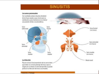 Sistema Respiratorio

                                         SINUSITIS

     Sistema


Fosas Nasales


     Faringe


     Laringe


     Tráquea


   Bronquios


 Bronquiolos


   Pulmones


    Fisiología




                 Anatomía y Fisiología                               18
 