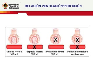 RELACIÓN VENTILACIÓN/PERFUSIÓN
 