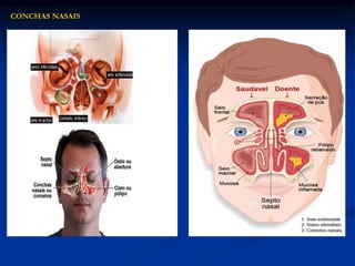 CONCHAS NASAIS
 