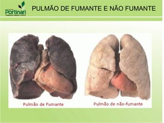 PULMÃO DE FUMANTE E NÃO FUMANTE
 