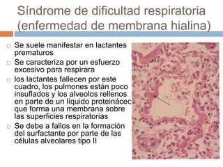 Síndrome de dificultad respiratoria
(enfermedad de membrana hialina)
 Se suele manifestar en lactantes
prematuros
 Se caracteriza por un esfuerzo
excesivo para respirara
 los lactantes fallecen por este
cuadro, los pulmones están poco
insuflados y los alveolos rellenos
en parte de un líquido proteináceo
que forma una membrana sobre
las superficies respiratorias
 Se debe a fallos en la formación
del surfactante por parte de las
células alveolares tipo II
 