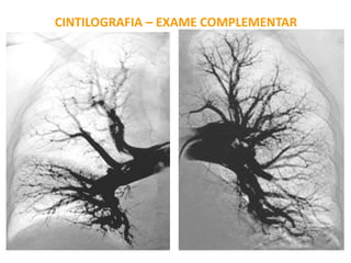 CINTILOGRAFIA – EXAME COMPLEMENTAR
 