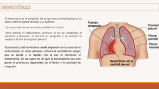 El pronóstico del hemotórax puede depender de la causa de la
enfermedad, en otras palabras, influirá la cantidad de sangre
que se pierde y la rapidez con la que se comience el
tratamiento. En los casos en los que el traumatismo sea más
grave, el pronóstico dependerá de la lesión y la cantidad de
sangrado.
El hemotórax es la presencia de sangre en la cavidad pleural, es
decir, entre la pared torácica y el pulmón.
La causa más común es un traumatismo torácico.
Para realizar el tratamiento, primero se ha de estabilizar al
paciente y después, se detiene el sangrado y se extraen la
sangre y el aire del espacio pleural.
 