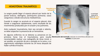 La sangre puede llegar al espacio pleural por lesión de la
pared torácica, diafragma, parénquima pulmonar, vasos
sanguíneos o desde estructuras mediastínicas.
Cuando la sangre se acumula en el espacio pleural, ésta
tiende a coagularse rápidamente, como resultado de los
movimientos producidos por el corazón y los pulmones.
Ante cualquier traumatismo, bien sea cerrado o abierto,
se debe sospechar la presencia de un hemotórax.
En algunos enfermos no se detecta su presencia en las
primeras horas tras el traumatismo, pero resulta
recomendable realizar una radiografía de tórax inicial, a
ser posible, en posición de pie o sentado en la cama, y un
seguimiento radiológico durante las 24 horas después de
haber sufrido el trauma.
HEMOTÓRAX TRAUMÁTICO
 