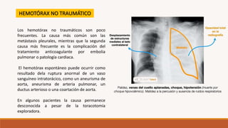 Los hemotórax no traumáticos son poco
frecuentes. La causa más común son las
metástasis pleurales, mientras que la segunda
causa más frecuente es la complicación del
tratamiento anticoagulante por embolia
pulmonar o patología cardiaca.
El hemotórax espontáneo puede ocurrir como
resultado dela ruptura anormal de un vaso
sanguíneo intratorácico, como un aneurisma de
aorta, aneurisma de arteria pulmonar, un
ductus arterioso o una coartación de aorta.
En algunos pacientes la causa permanece
desconocida a pesar de la toracotomía
exploradora.
HEMOTÓRAX NO TRAUMÁTICO
 