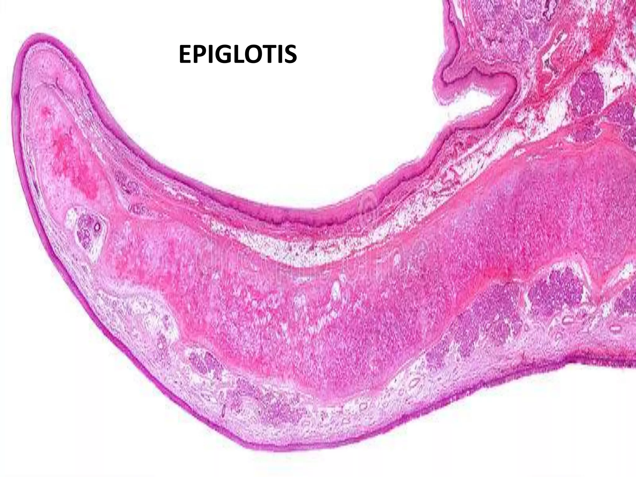 EPIGLOTIS
 