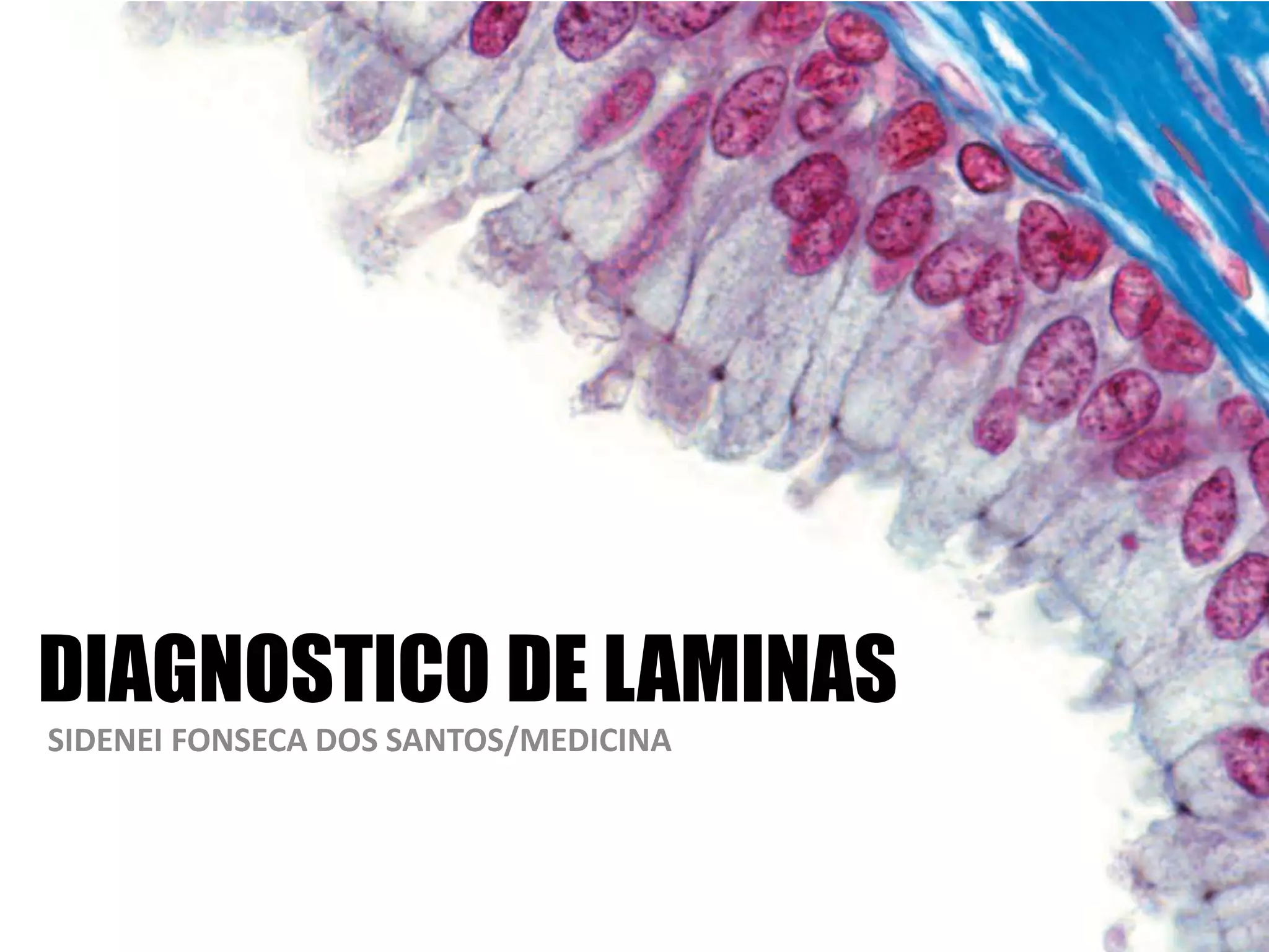 DIAGNOSTICO DE LAMINAS
SIDENEI FONSECA DOS SANTOS/MEDICINA
 