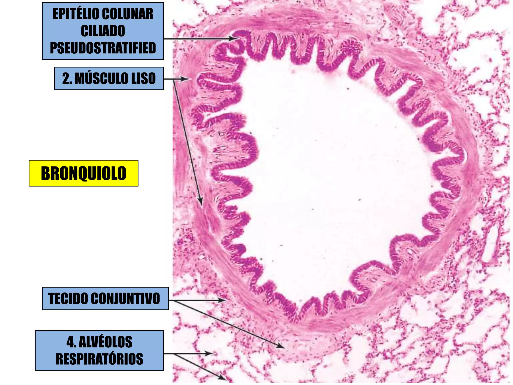 EPITÉLIO COLUNAR
CILIADO
PSEUDOSTRATIFIED
2. MÚSCULO LISO
TECIDO CONJUNTIVO
4. ALVÉOLOS
RESPIRATÓRIOS
BRONQUIOLO
 