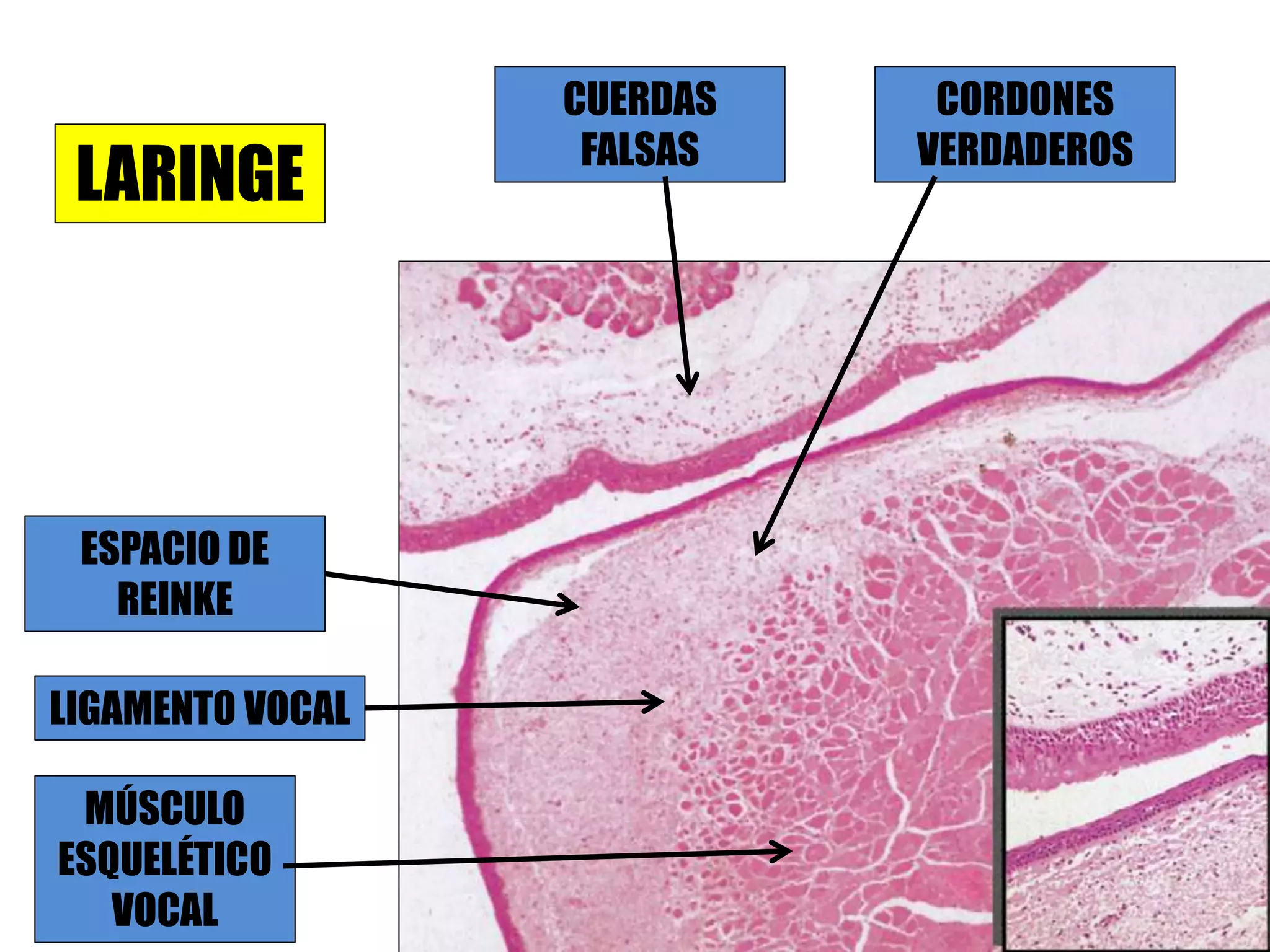 CUERDAS
FALSAS
CORDONES
VERDADEROS
ESPACIO DE
REINKE
LIGAMENTO VOCAL
MÚSCULO
ESQUELÉTICO
VOCAL
LARINGE
 