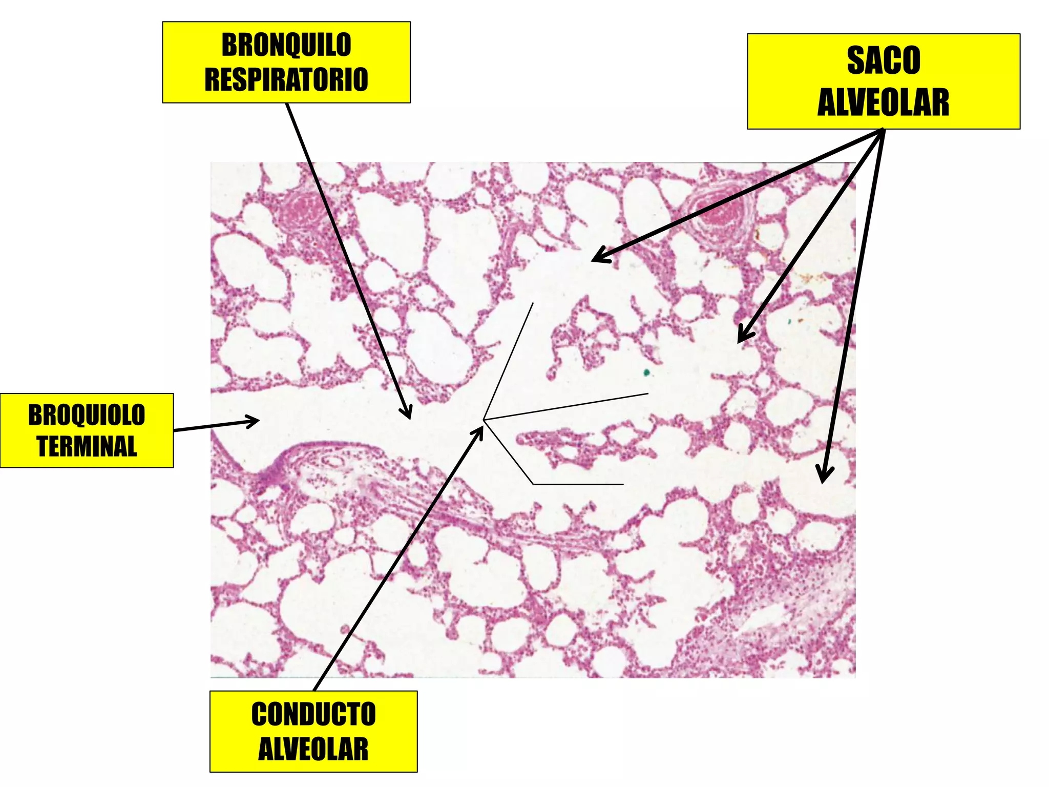 BROQUIOLO
TERMINAL
BRONQUILO
RESPIRATORIO
CONDUCTO
ALVEOLAR
SACO
ALVEOLAR
 