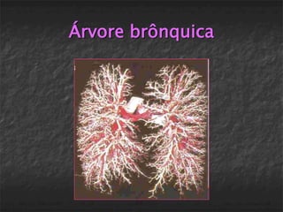 Árvore brônquica
 