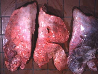 FASE DE HEPATIZAÇÃO CINZENTA 