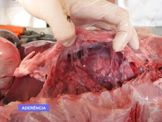 BRONCOPNEUMONIA Problemas na fase de resolução ADERÊNCIA 