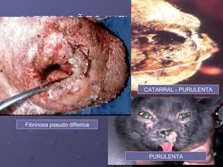 ALTERAÇÕES INFLAMATÓRIAS IMAGEM HVB-1 PURULENTA CATARRAL - PURULENTA Fibrinosa pseudo difterica 