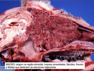NEOPLASIAS DA CAVIDADE NASAL E SEIOS PARANASAIS MACRO: origem na região etmoidal, massas amareladas, flácidas, friaveis  e fétidas que destroem as estruturas adjacentes 