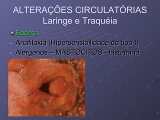 Edema  Anafilaxia (Hipersensibilidade do tipo I) Alergenos – MASTOCITOS - histamina ALTERAÇÕES CIRCULATÓRIAS Laringe e Traquéia 