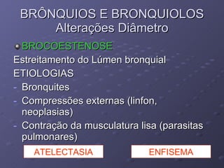 BROCOESTENOSE Estreitamento do Lúmen bronquial ETIOLOGIAS Bronquites Compressões externas (linfon, neoplasias) Contração da musculatura lisa (parasitas pulmonares) BRÔNQUIOS E BRONQUIOLOS Alterações Diâmetro ATELECTASIA ENFISEMA 